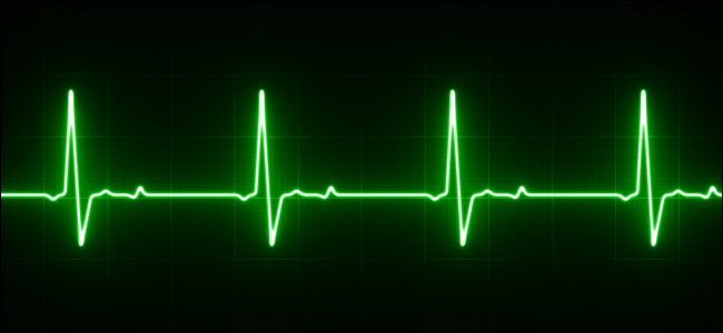 EKG کیا ہے، اور یہ نئی ایپل واچ میں کیسے کام کرتا ہے؟